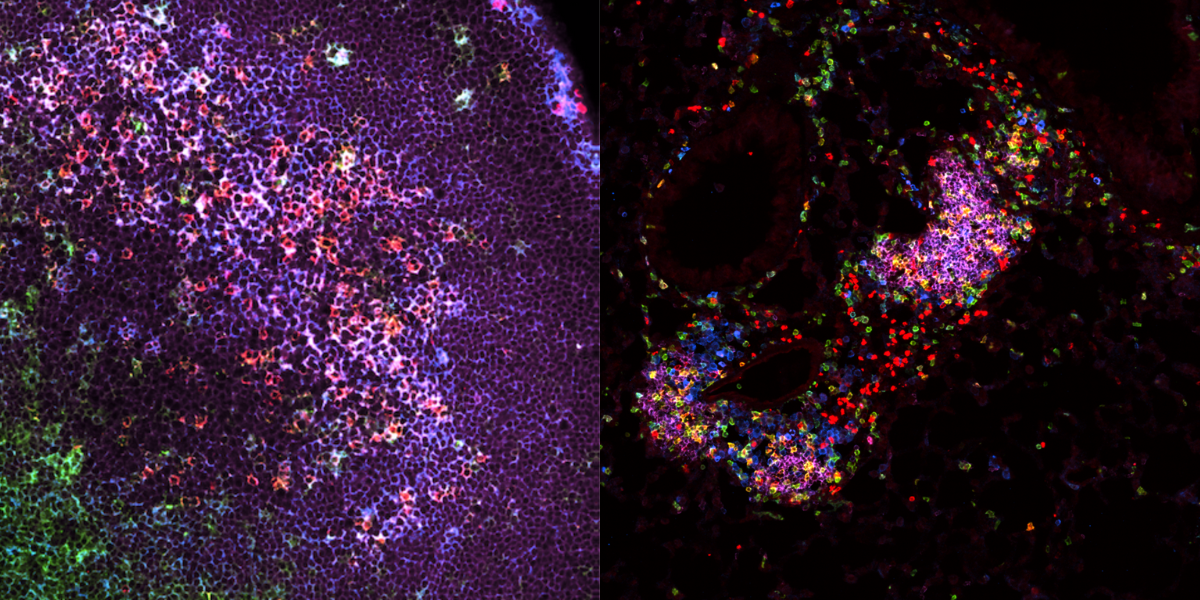 Comparison of immune response in lung and lymph node reveals surprising quality of tissue-resident reaction